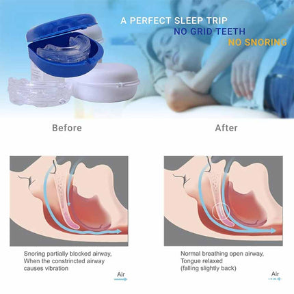 Anti Snore Device Anti Snoring Solution Mouthpiece Sleep Aid