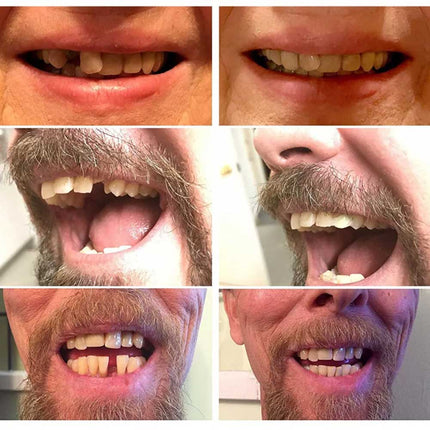 3X Instant Smile Comfort Fit Flex Teeth Top Temporary Replacement Repair