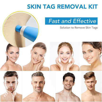 Auto Micro Skin Tag Remover Device Kit, Painless Removal 2-8mm
