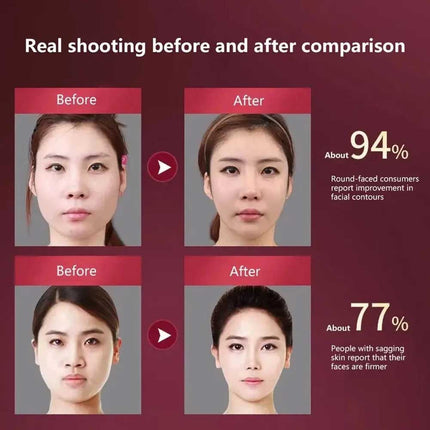 V-Face Shape Massager LED Photon Therapy: Skin Neck Lift, Slim Double-Chin Removal