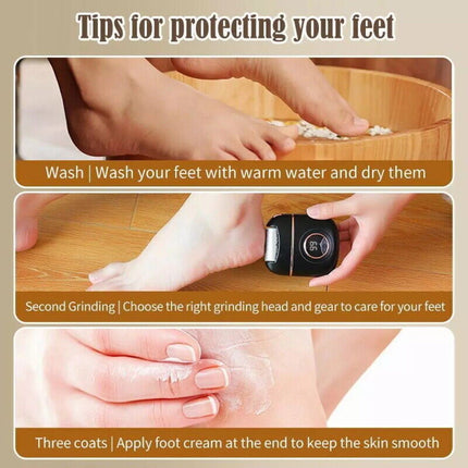 Electric Foot Callus Remover Grinder File Professional Dead Skin Tool + Tips