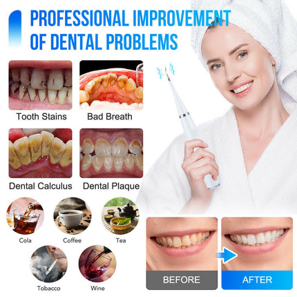 6in1 Ultrasonic Electric Toothbrush Teeth Stains Plaque Remover Cleaner