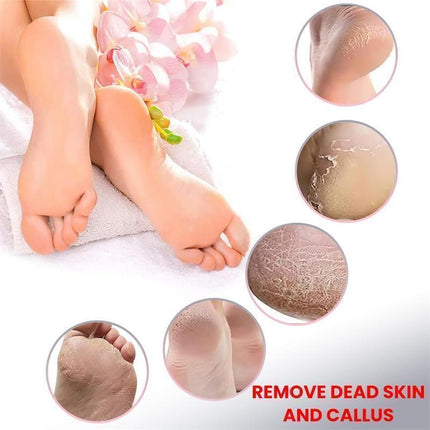 Electric Foot Callus Remover Grinder File Professional Dead Skin Tool + Tips