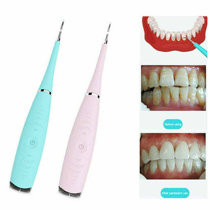 Portable Electric Dental Scaler Tool for Plaque, Tartar & Stains