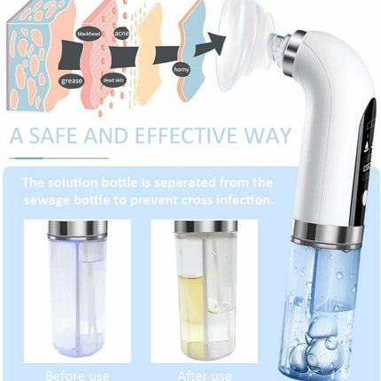 Facial Vacuum Blackhead Remover Skin Pore Acne Suction Cleaner Machine