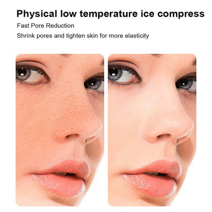 Facial Ice Roller Massager Cube Depuff Lifting Contour Face Care Tool