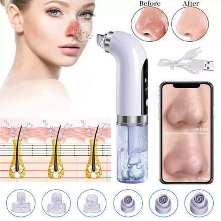 Facial Vacuum Blackhead Remover Skin Pore Acne Suction Cleaner Machine