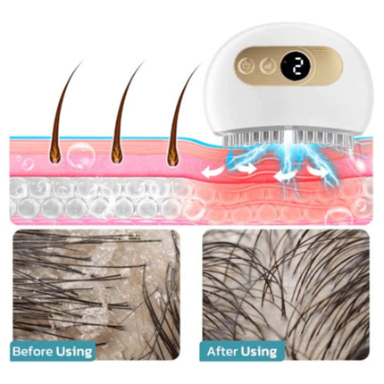 EMS Facial Lifting & Scalp Acupoint Massager, Nourishing Relax Device