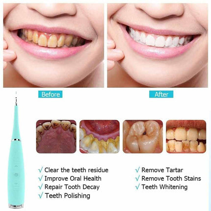 Portable Electric Dental Scaler Tool for Plaque, Tartar & Stains