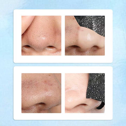 50PCS Nose Pore Strips Blackhead Remover Deep Cleansing Unclog Pores