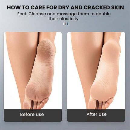 Electric Foot Callus Remover Grinder File Professional Dead Skin Tool + Tips