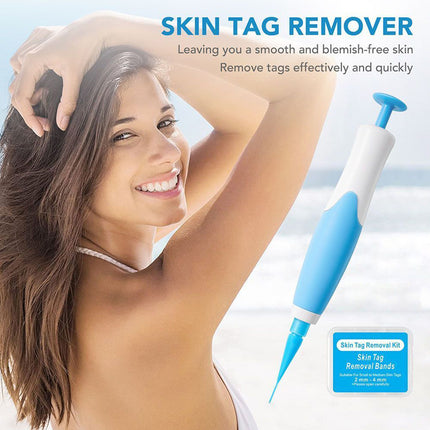 Auto Micro Skin Tag Remover Device Kit, Painless Removal 2-8mm