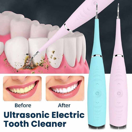 Portable Electric Dental Scaler Tool for Plaque, Tartar & Stains
