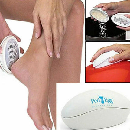 Ped Egg Foot File Callus Remover Hard Skin Remover Pedicure Tool
