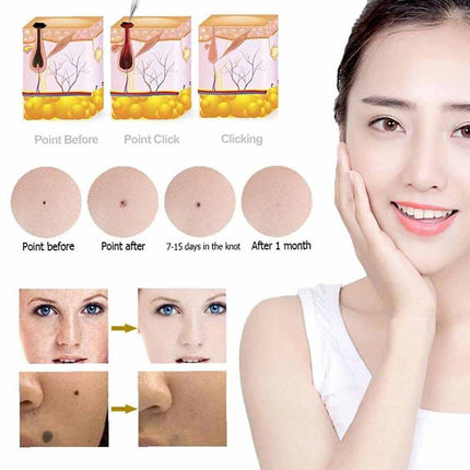 Laser Plasma Pen Skin Remover Machine LCD Freckle Mole Wart Dark Spot
