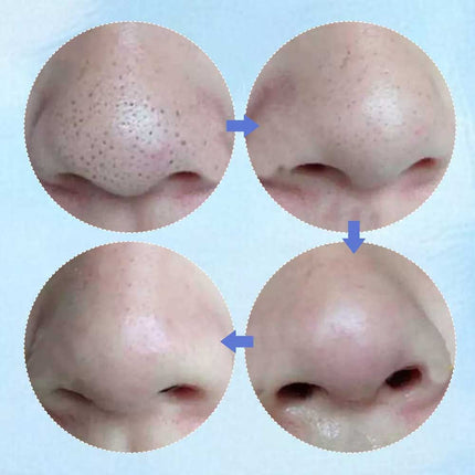 50PCS Nose Pore Strips Blackhead Remover Deep Cleansing Unclog Pores