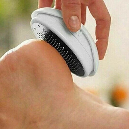 Ped Egg Foot File Callus Remover Hard Skin Remover Pedicure Tool