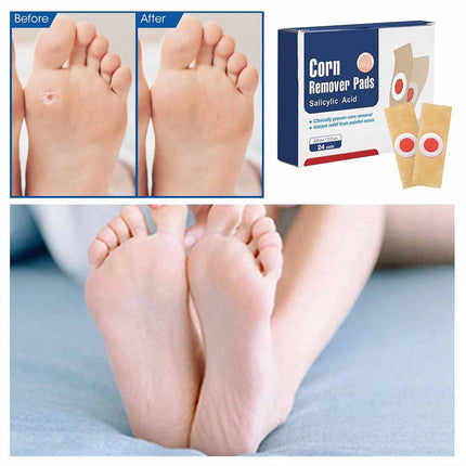 24pcs Gentle Corn Pads for Toes, Callus Removal Adhesive Pads for Feet