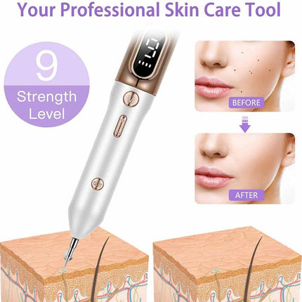 Laser Plasma Pen Skin Remover Machine LCD Freckle Mole Wart Dark Spot
