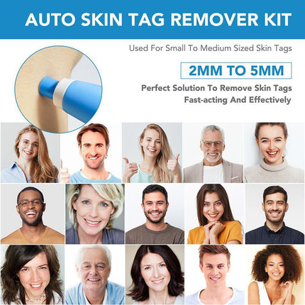 Auto Micro Skin Tag Remover Device Kit, Painless Removal 2-8mm