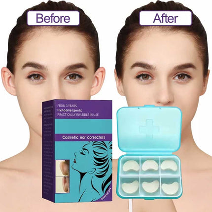 6 Pcs Box Earlap Ear Corrector Cosmetic Prominent Ears Correction Device