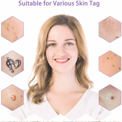 Laser Plasma Pen Skin Remover Machine LCD Freckle Mole Wart Dark Spot